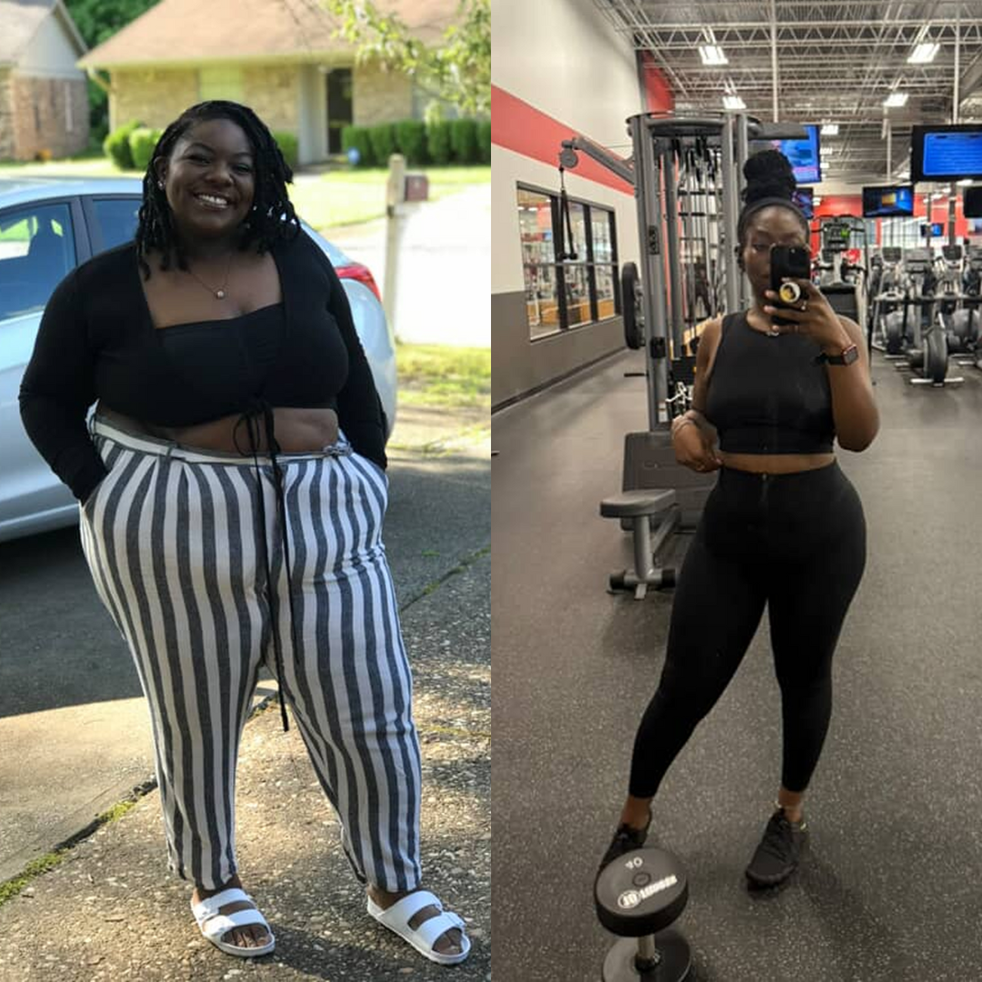 Medical Weight Loss in Tulsa Before & After Photos