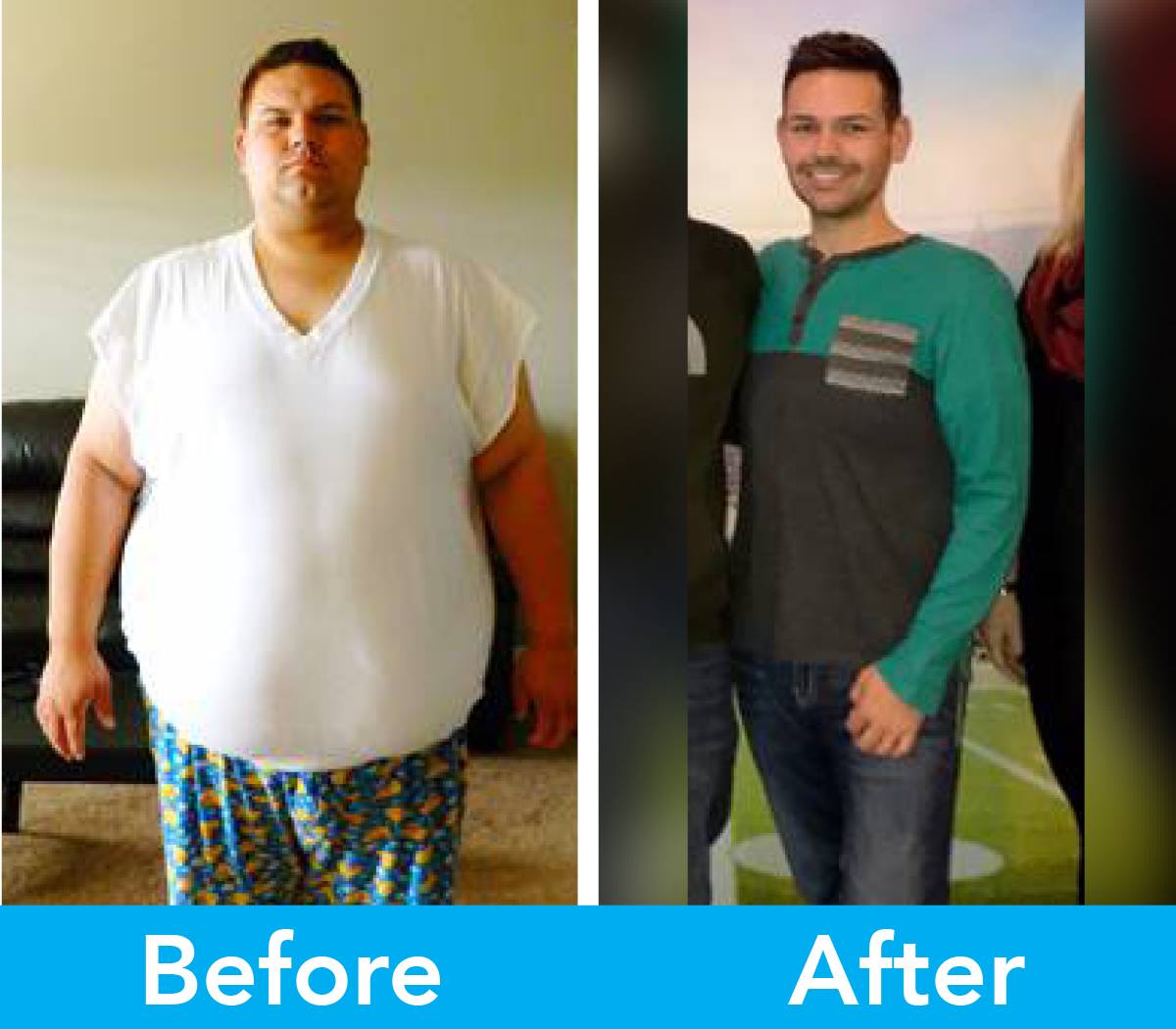Medical Weight Loss in Tulsa Before & After Photos