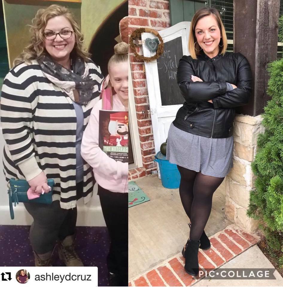 Medical Weight Loss in Tulsa Before & After Photos