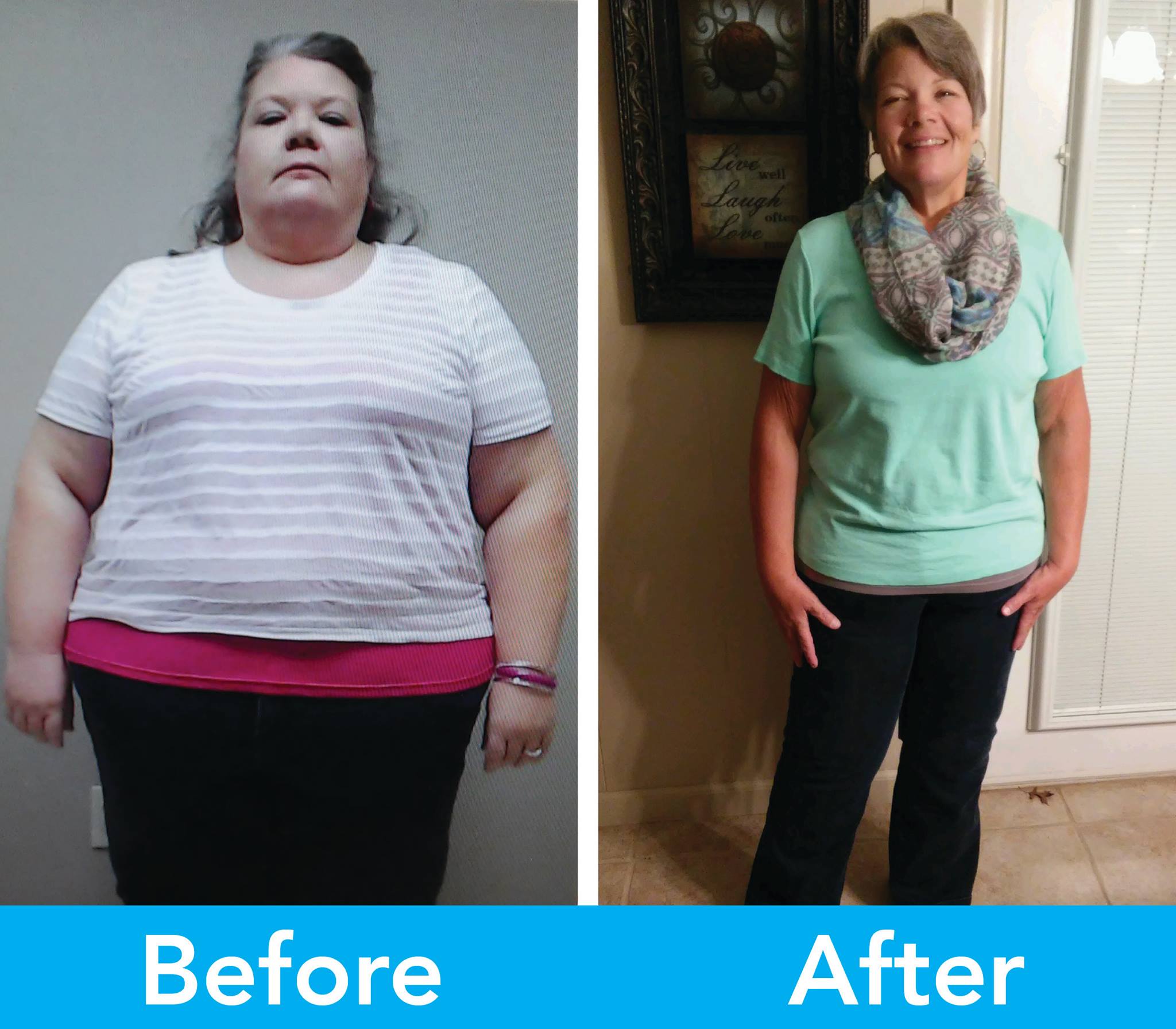 Medical Weight Loss in Tulsa Before & After Photos