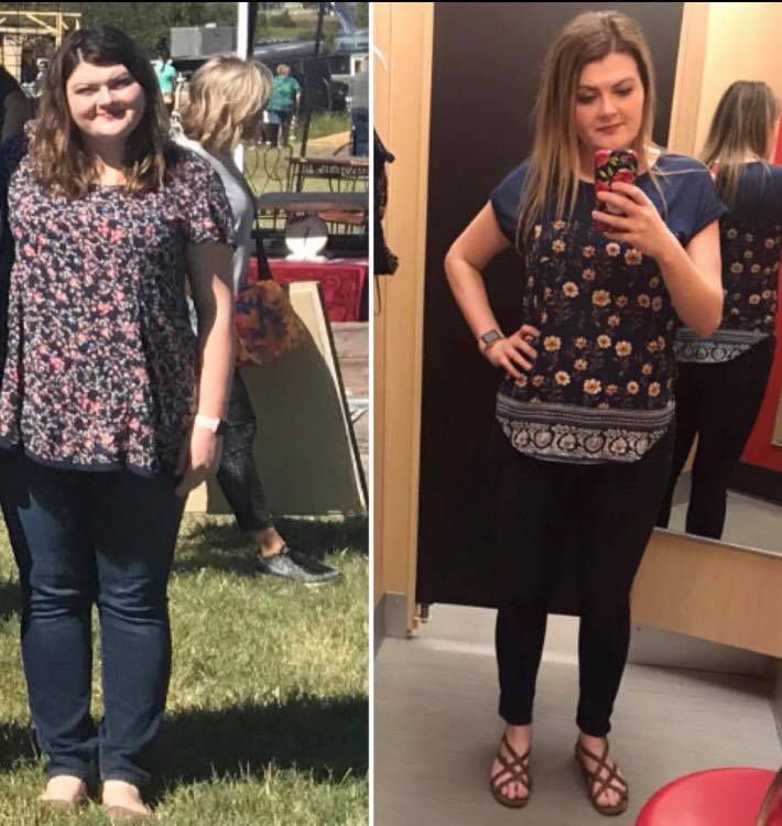 Medical Weight Loss in Tulsa Before & After Photos