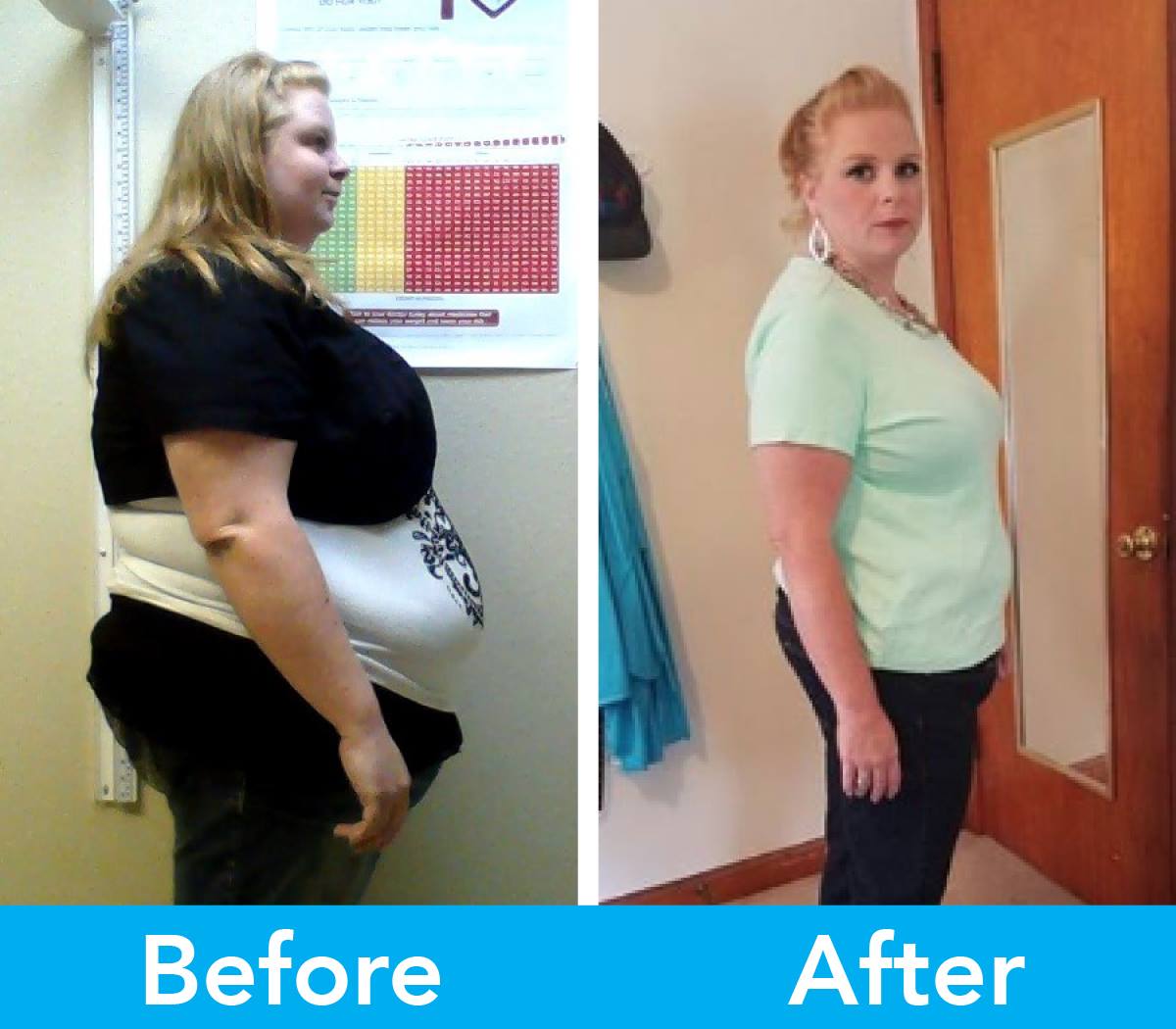 Medical Weight Loss in Tulsa Before & After Photos
