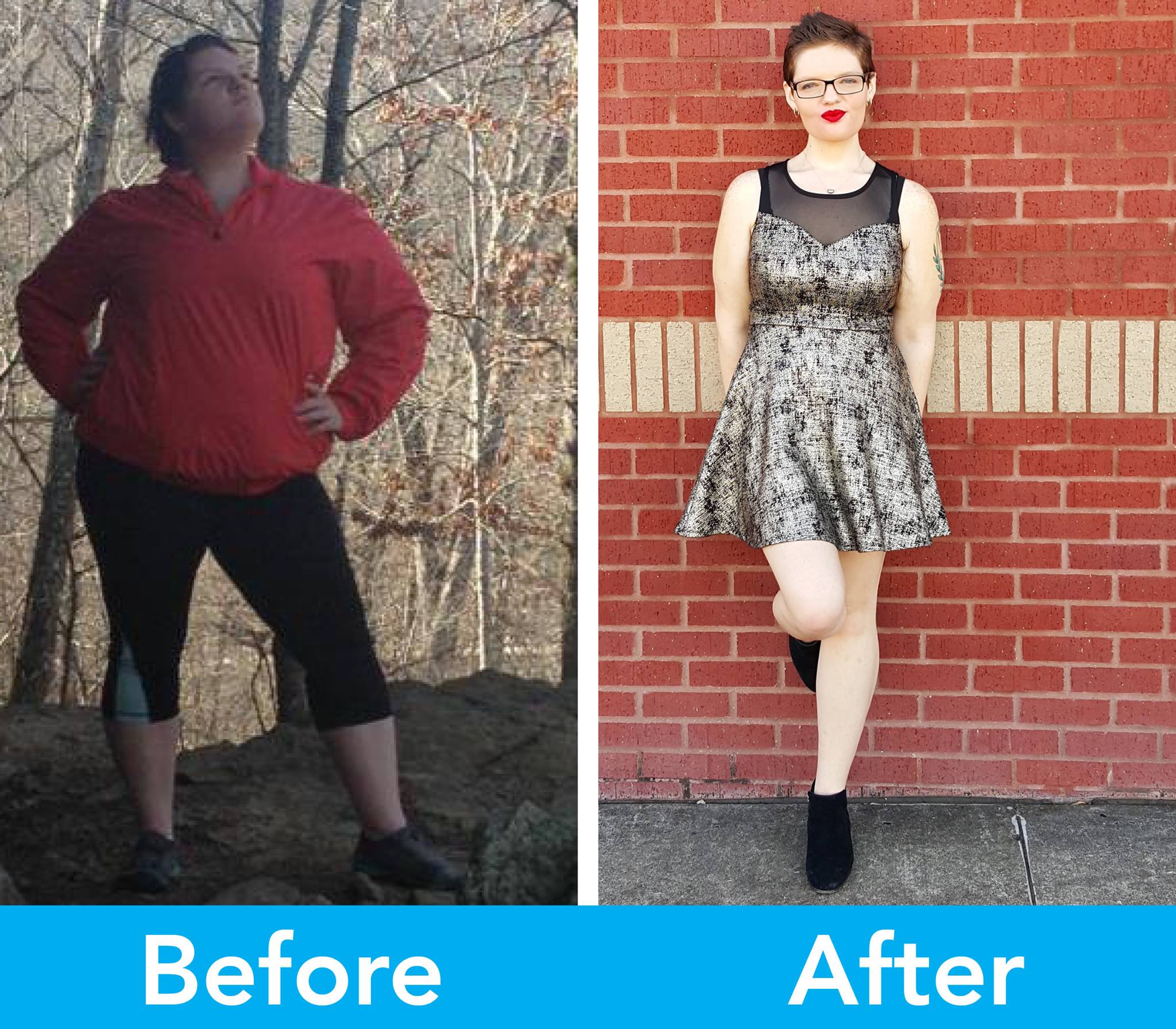 Medical Weight Loss in Tulsa Before & After Photos