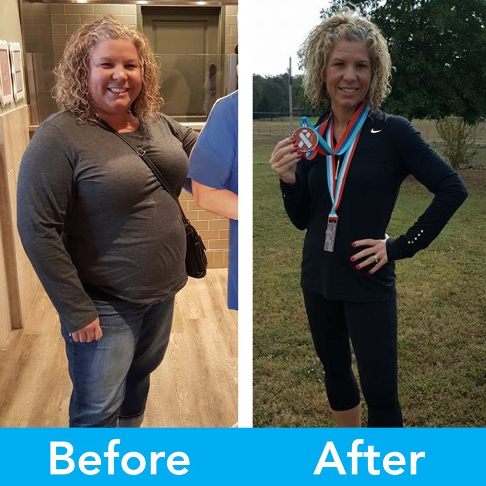 Medical Weight Loss in Tulsa Before & After Photos