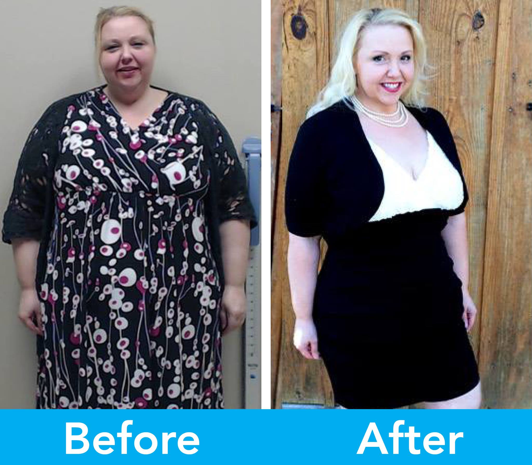 Medical Weight Loss in Tulsa Before & After Photos