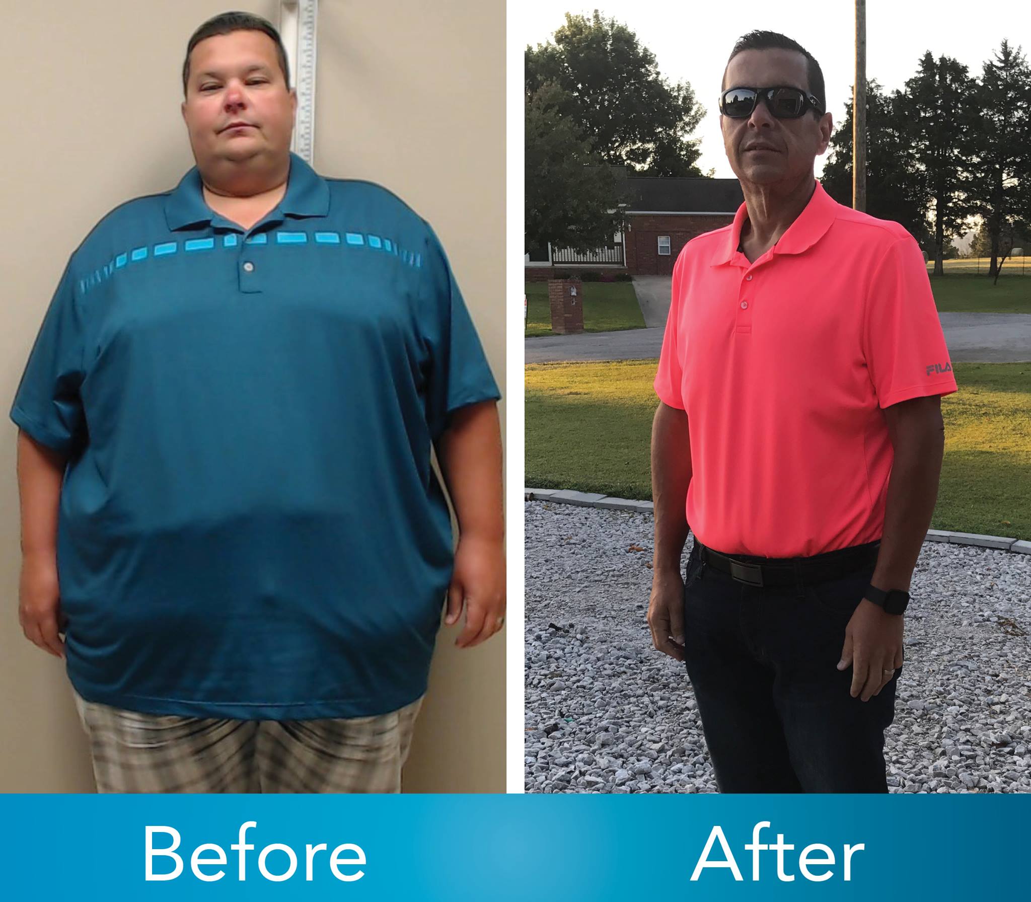 Medical Weight Loss in Tulsa Before & After Photos