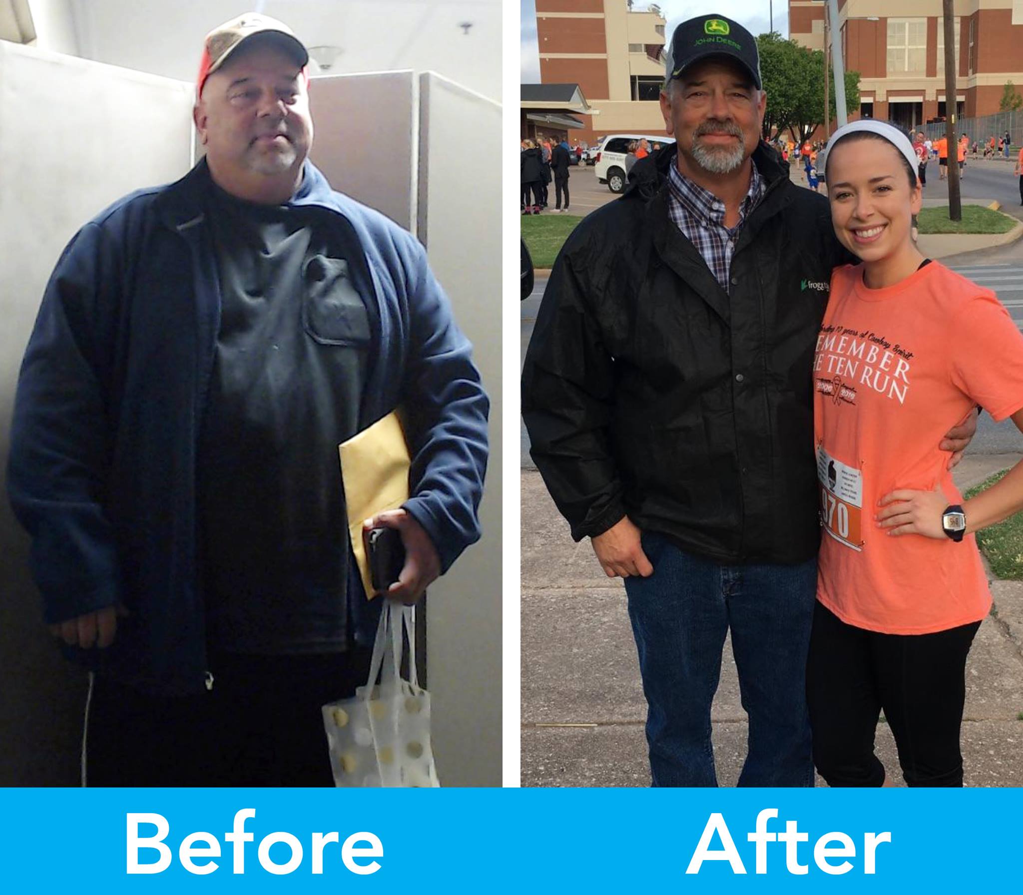 Medical Weight Loss in Tulsa Before & After Photos