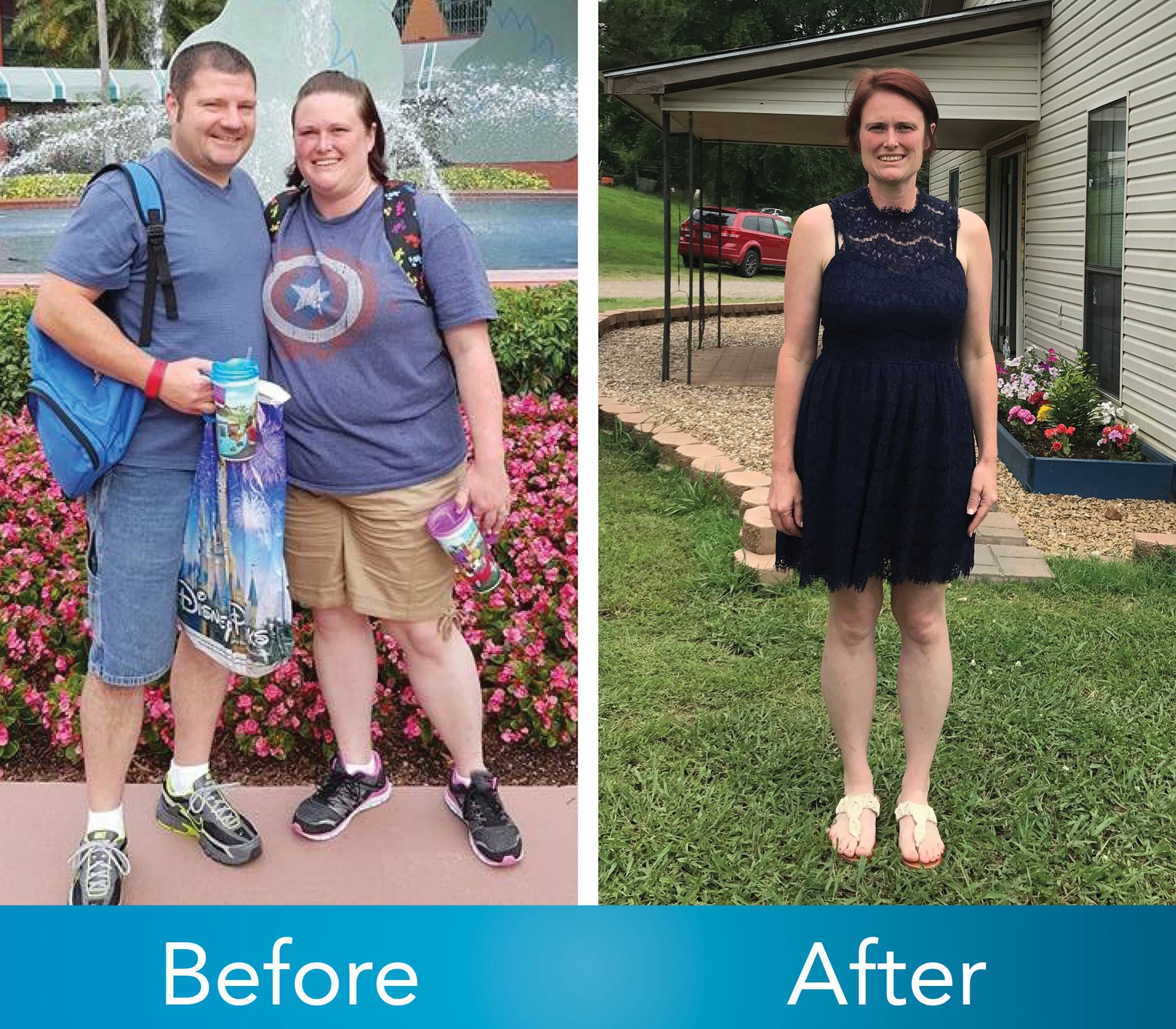 Medical Weight Loss in Tulsa Before & After Photos