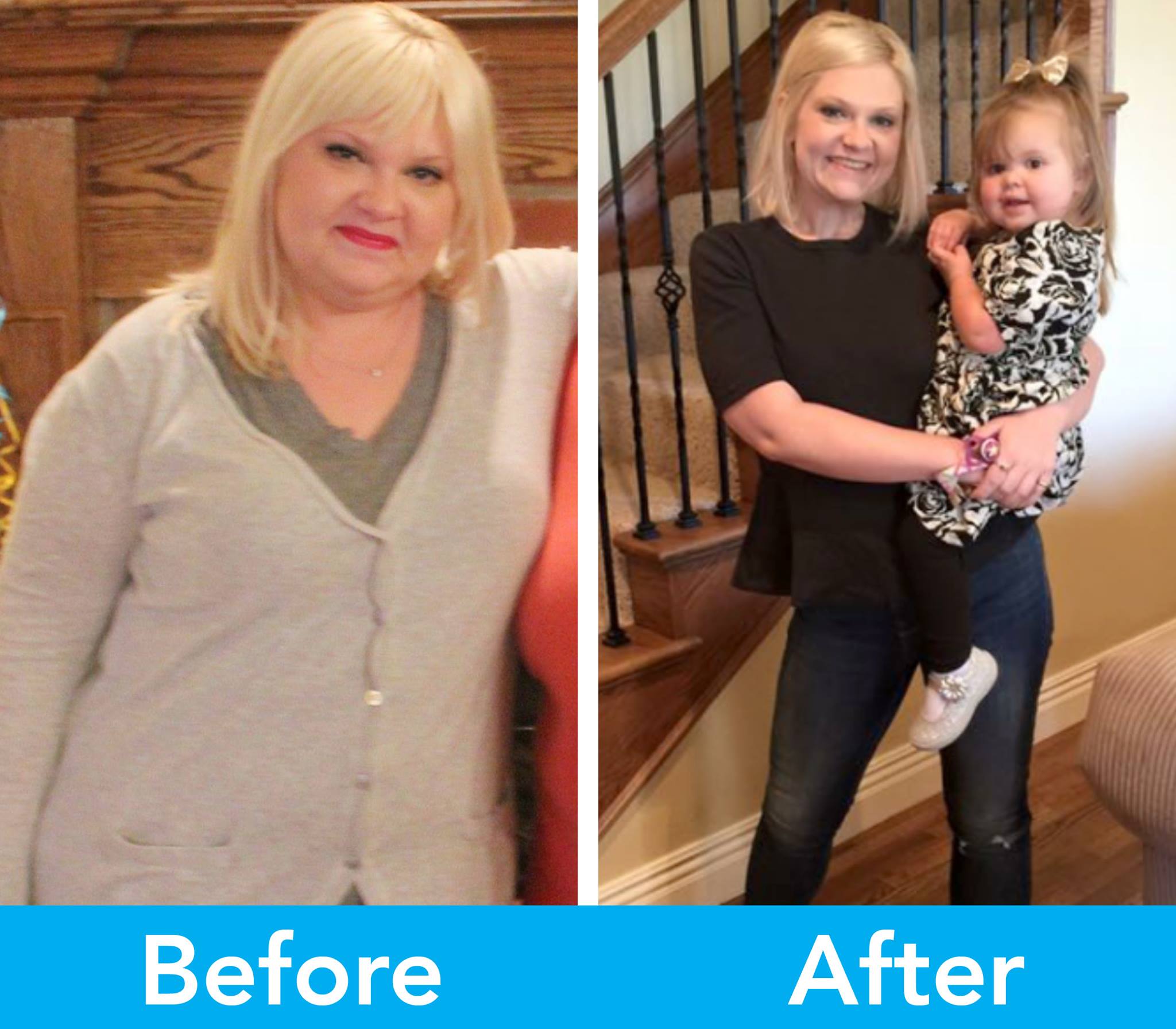 Medical Weight Loss in Tulsa Before & After Photos