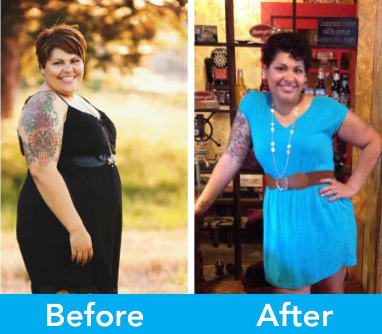 Medical Weight Loss in Tulsa Before & After Photos