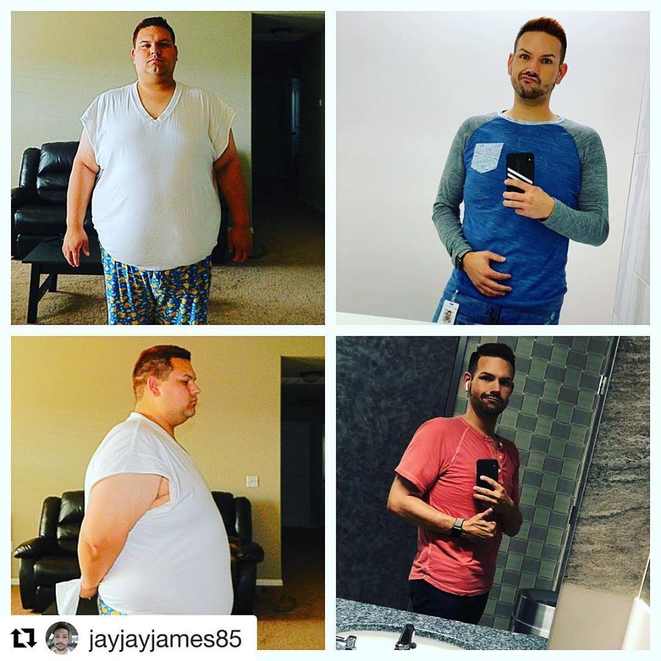 Medical Weight Loss in Tulsa Before & After Photos