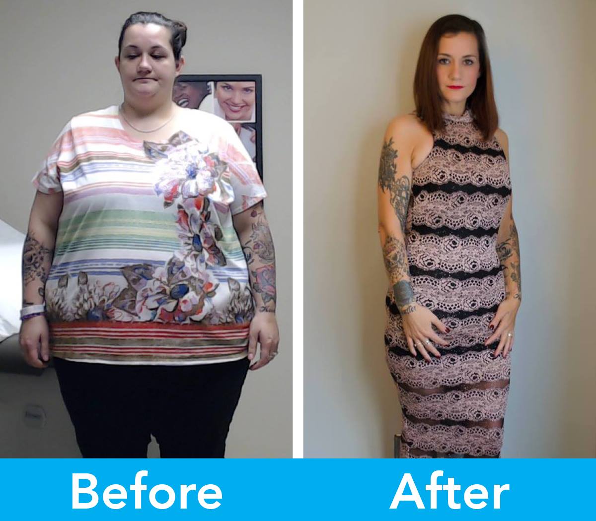Medical Weight Loss in Tulsa Before & After Photos