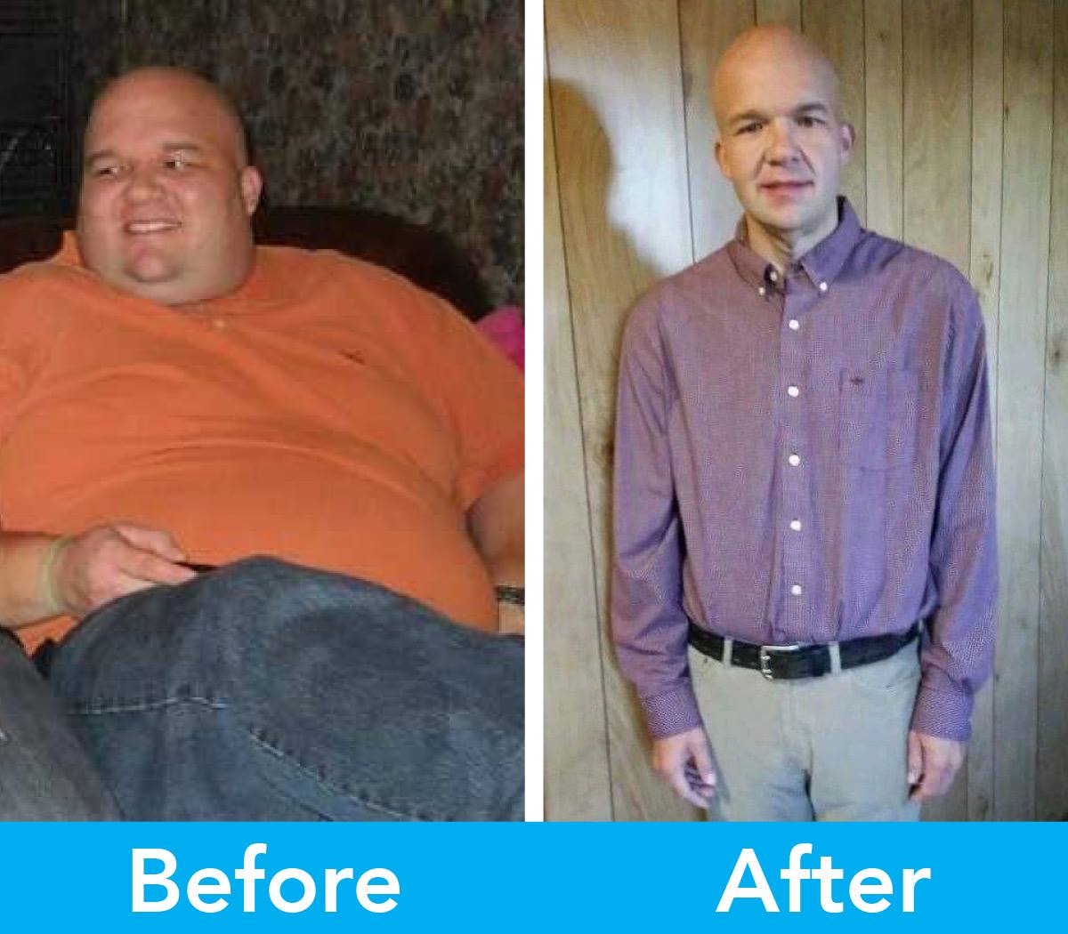 Medical Weight Loss in Tulsa Before & After Photos