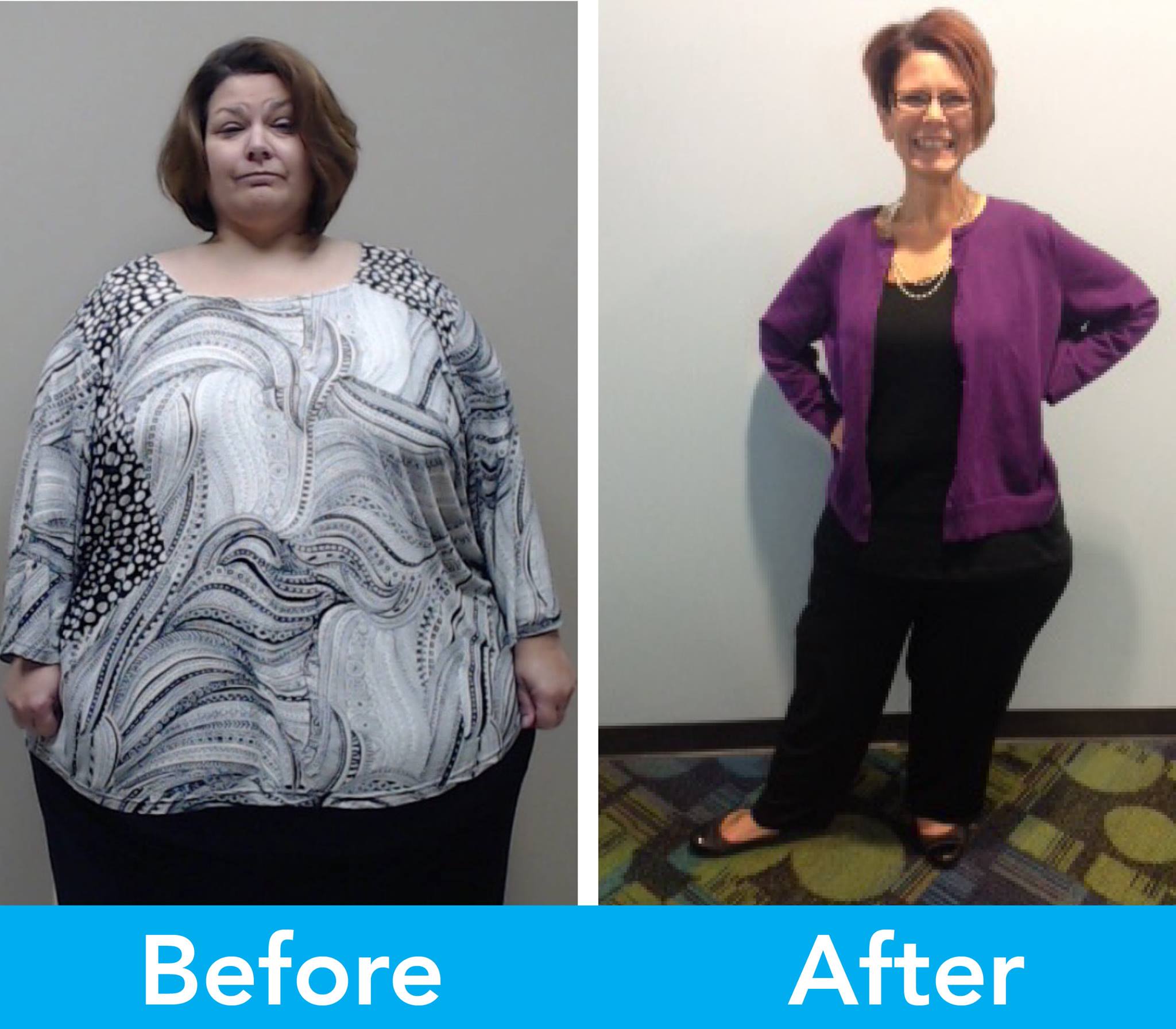 Medical Weight Loss in Tulsa Before & After Photos