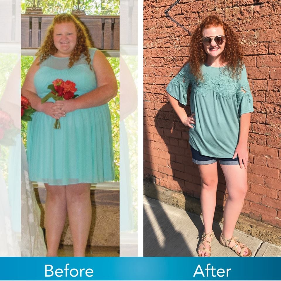 Medical Weight Loss in Tulsa Before & After Photos