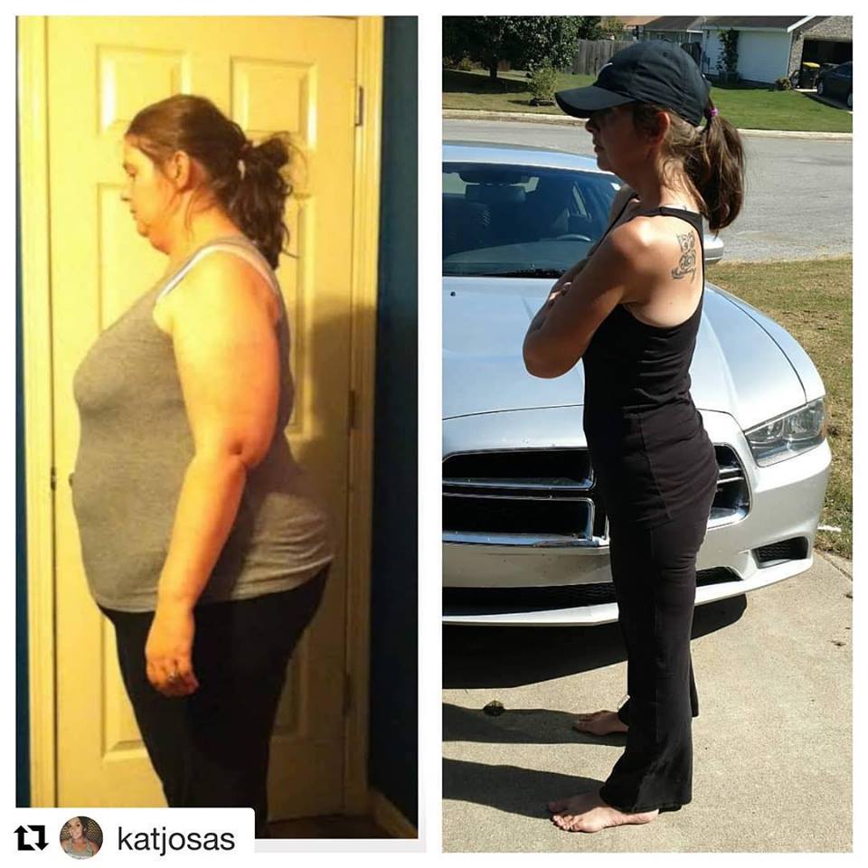 Medical Weight Loss in Tulsa Before & After Photos