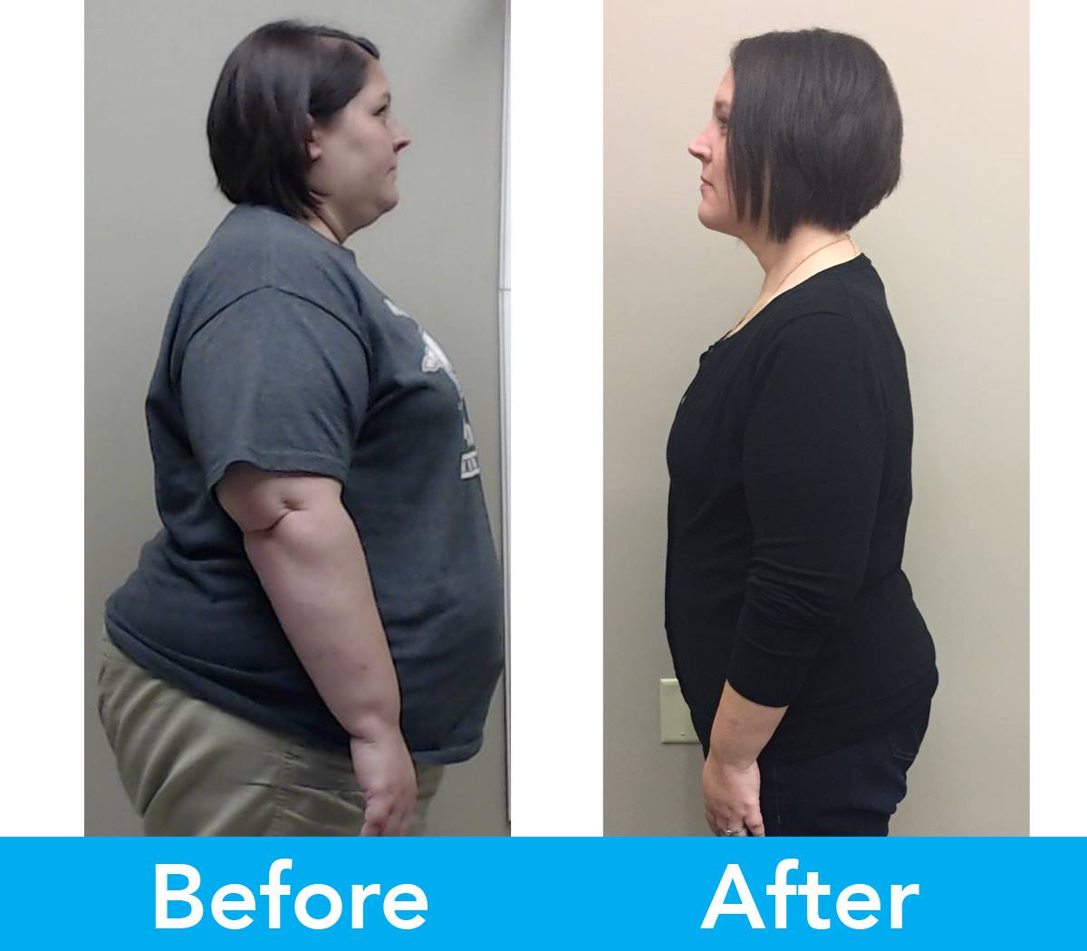Medical Weight Loss in Tulsa Before & After Photos