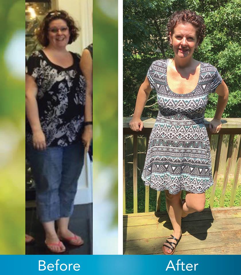 Medical Weight Loss in Tulsa Before & After Photos