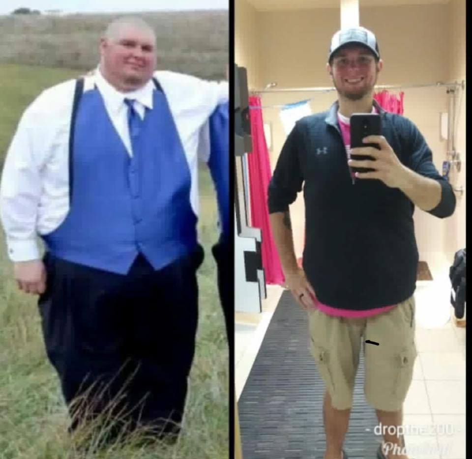 Medical Weight Loss in Tulsa Before & After Photos