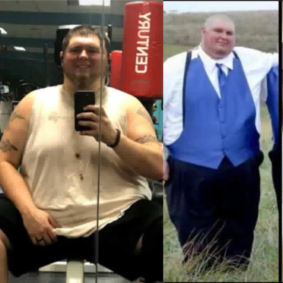 Medical Weight Loss in Tulsa Before & After Photos