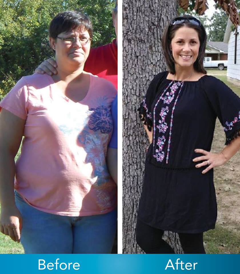 Medical Weight Loss in Tulsa Before & After Photos