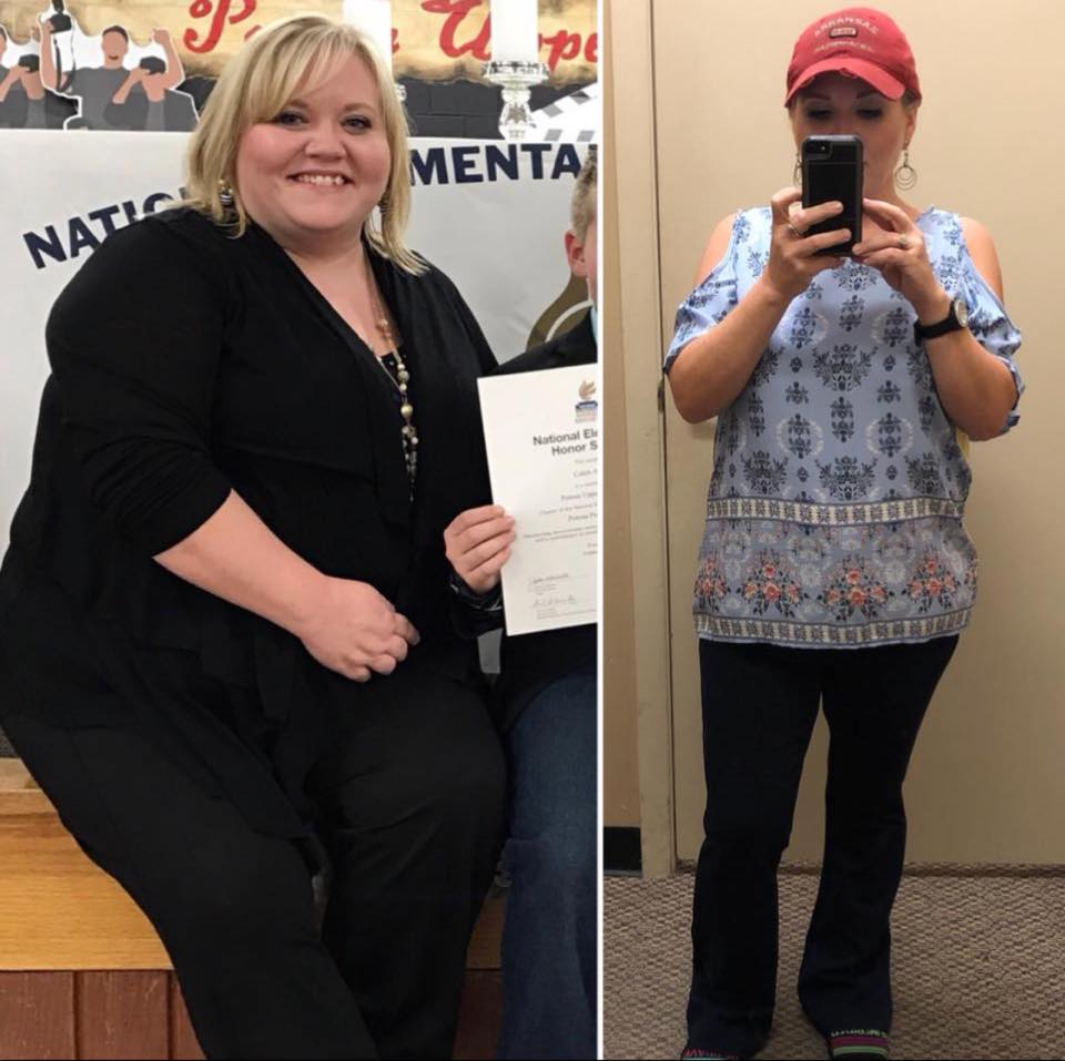 Medical Weight Loss in Tulsa Before & After Photos