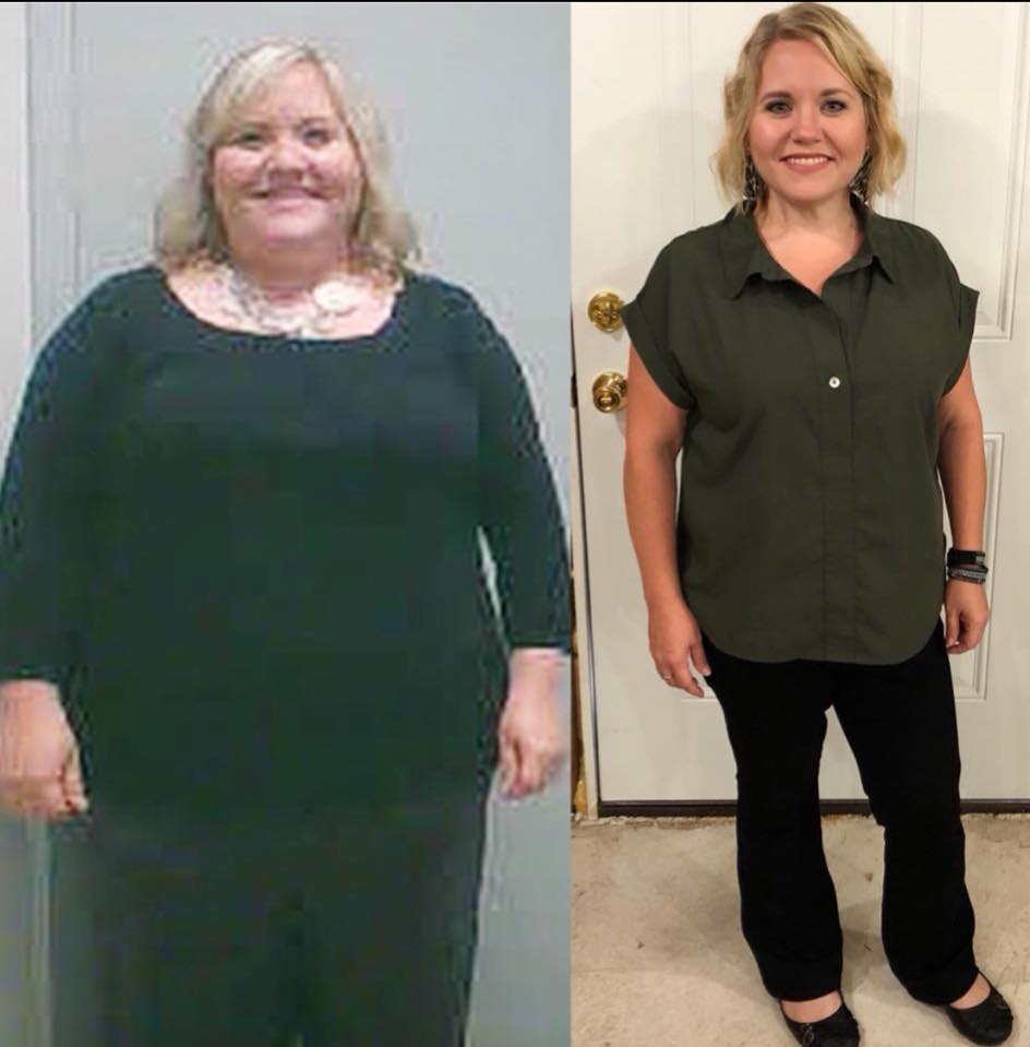 Medical Weight Loss in Tulsa Before & After Photos