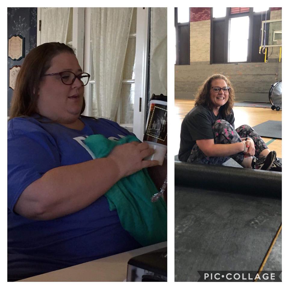 Medical Weight Loss in Tulsa Before & After Photos