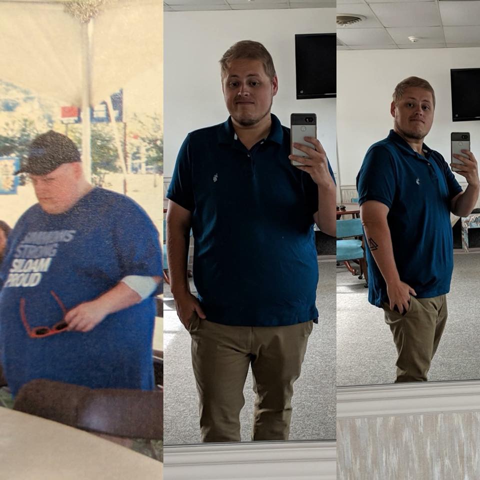 Medical Weight Loss in Tulsa Before & After Photos