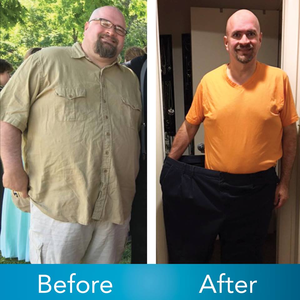 Medical Weight Loss in Tulsa Before & After Photos