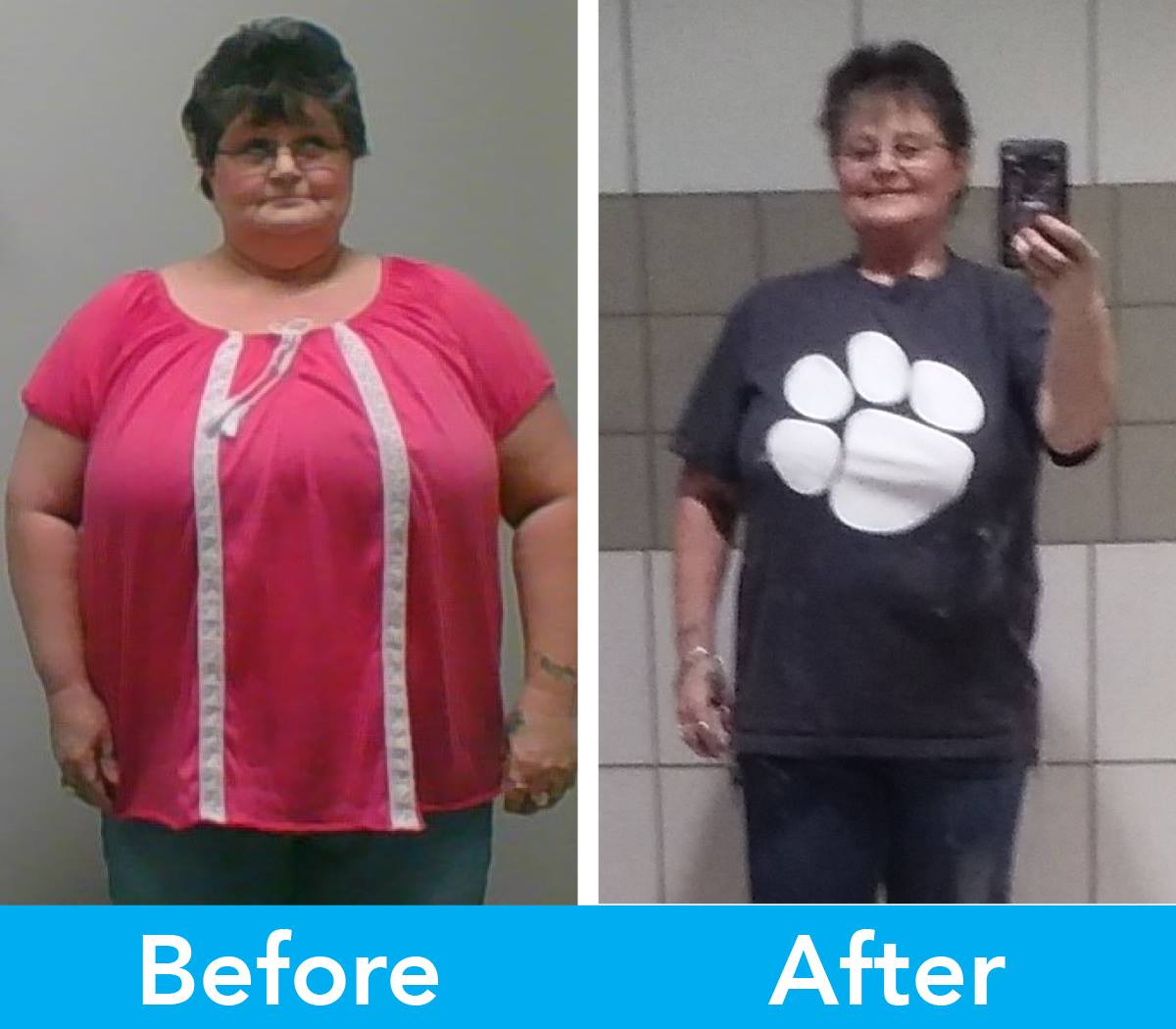 Medical Weight Loss in Tulsa Before & After Photos