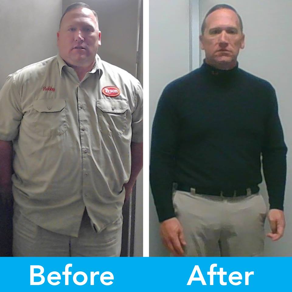 Medical Weight Loss in Tulsa Before & After Photos