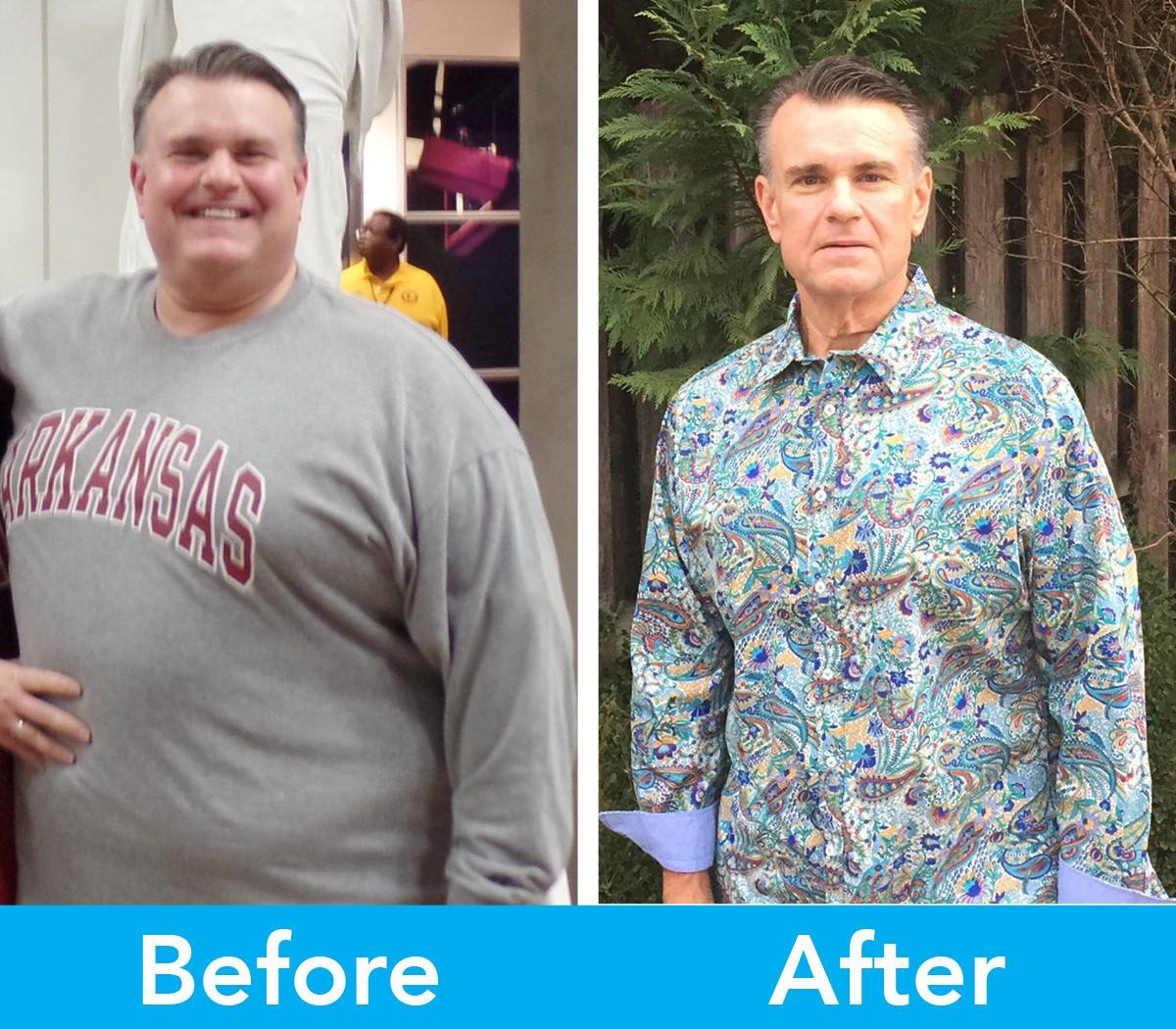 Medical Weight Loss in Tulsa Before & After Photos