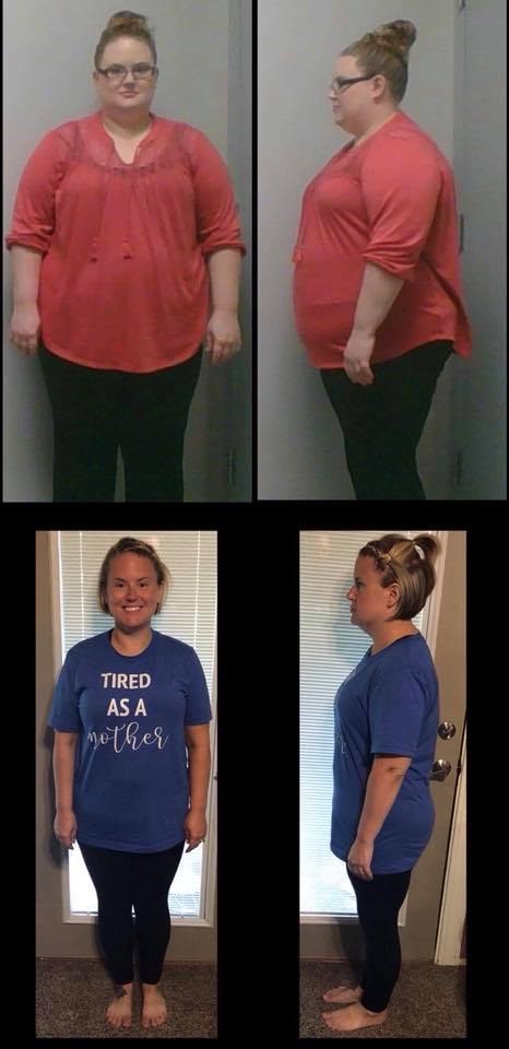 Medical Weight Loss in Tulsa Before & After Photos