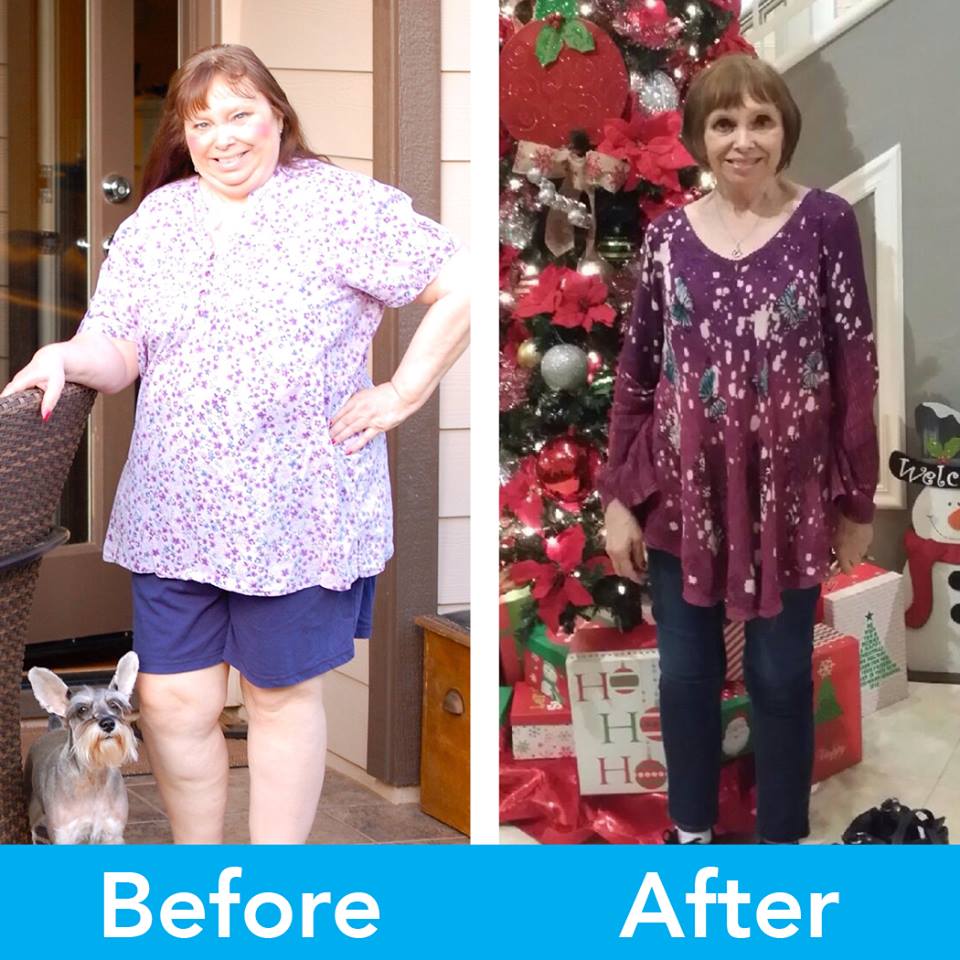 Medical Weight Loss in Tulsa Before & After Photos