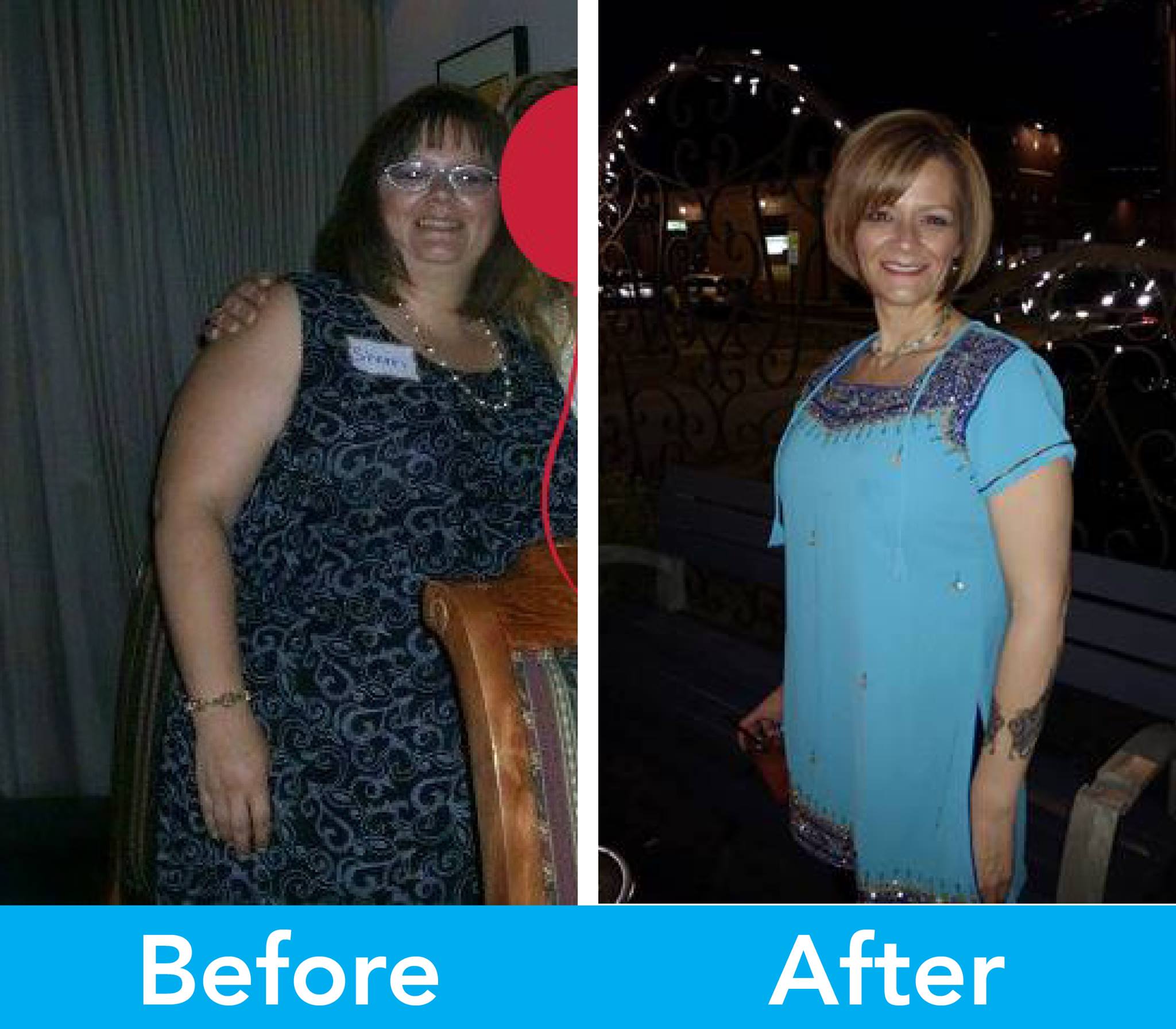 Medical Weight Loss in Tulsa Before & After Photos