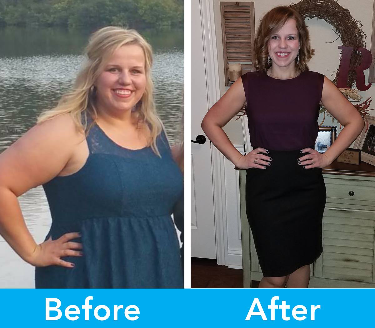 Medical Weight Loss in Tulsa Before & After Photos