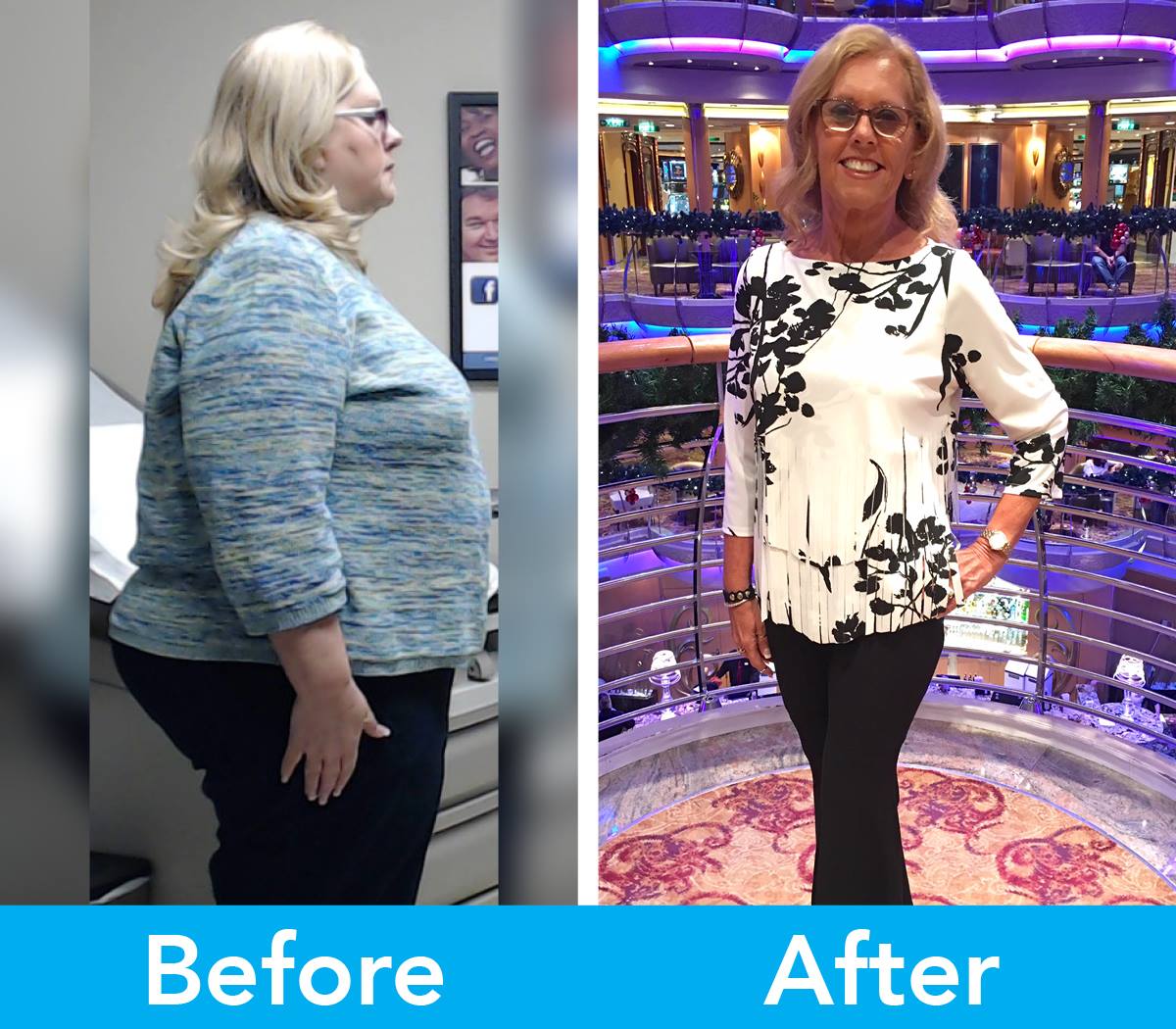 Medical Weight Loss in Tulsa Before & After Photos