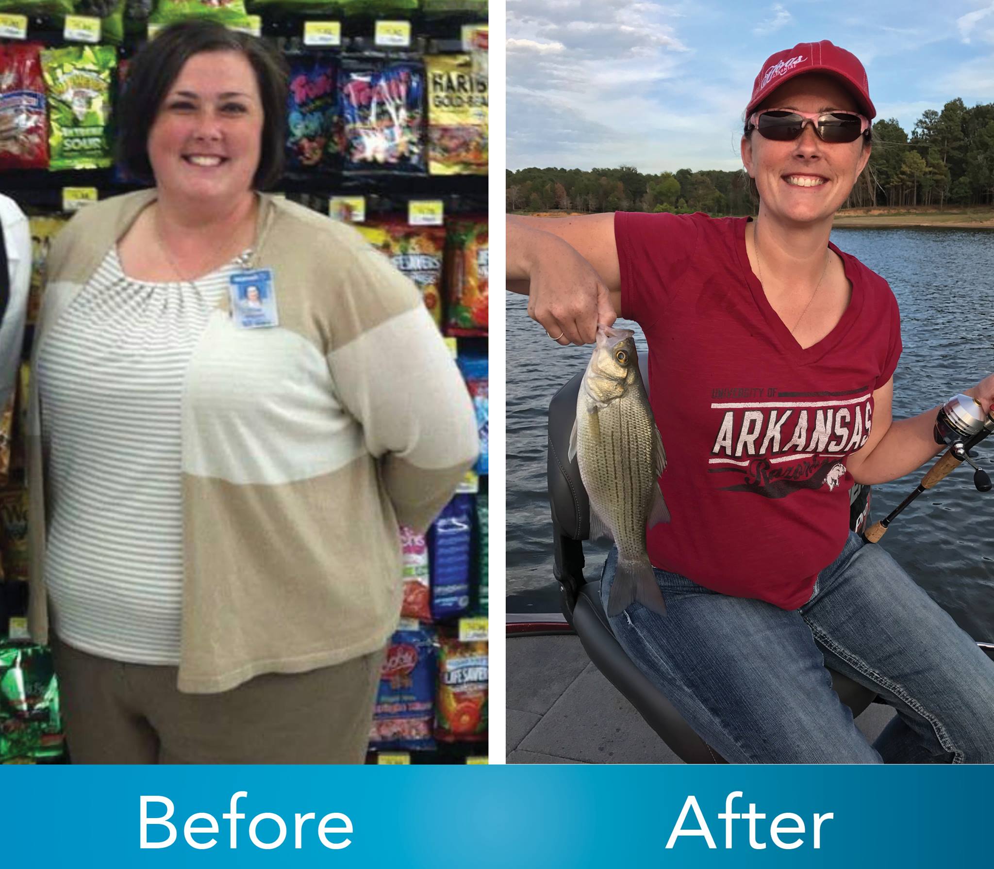 Medical Weight Loss in Tulsa Before & After Photos