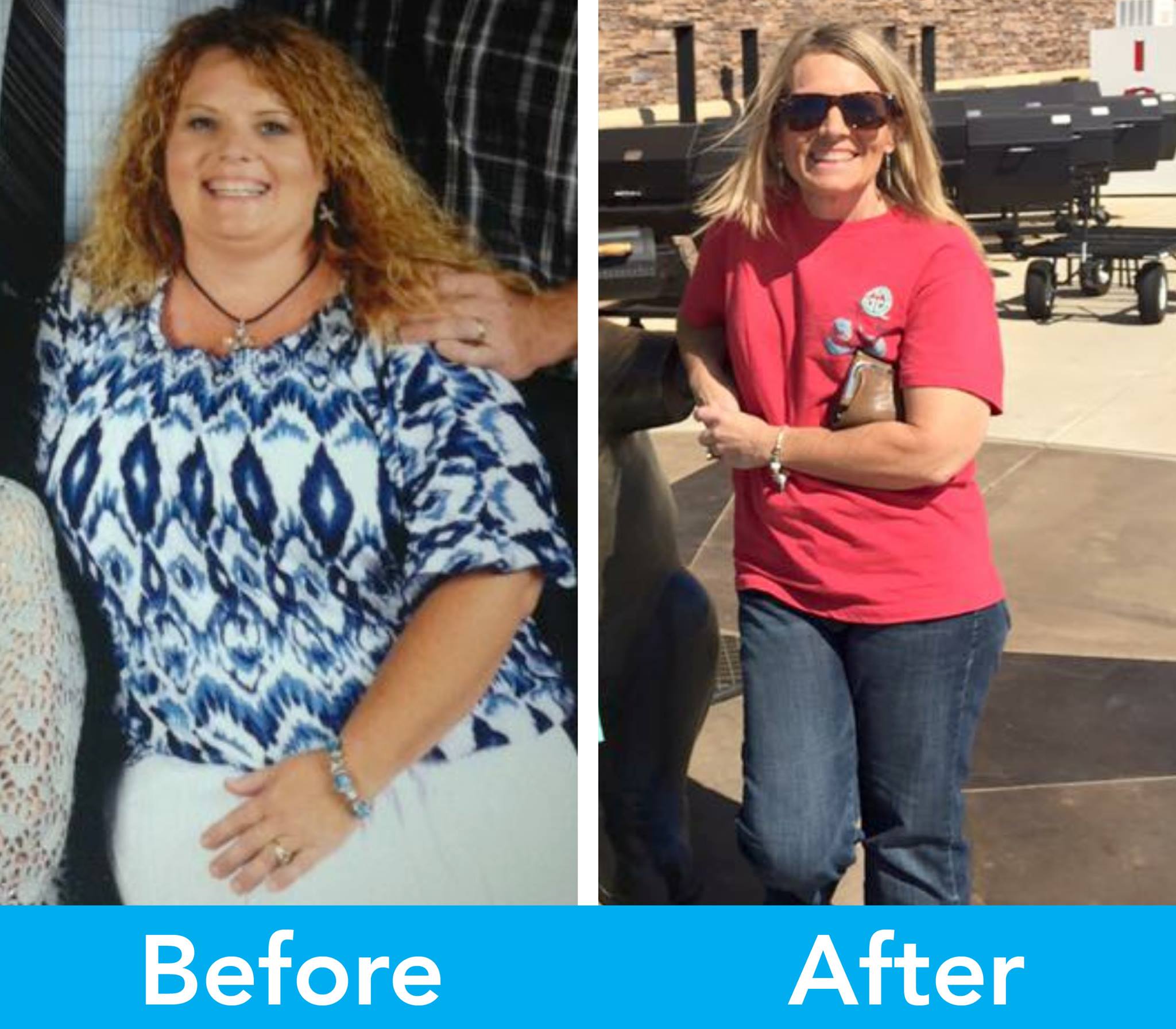Medical Weight Loss in Tulsa Before & After Photos