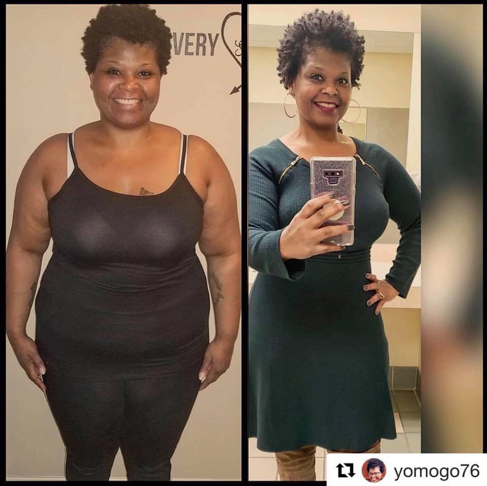 Medical Weight Loss in Tulsa Before & After Photos