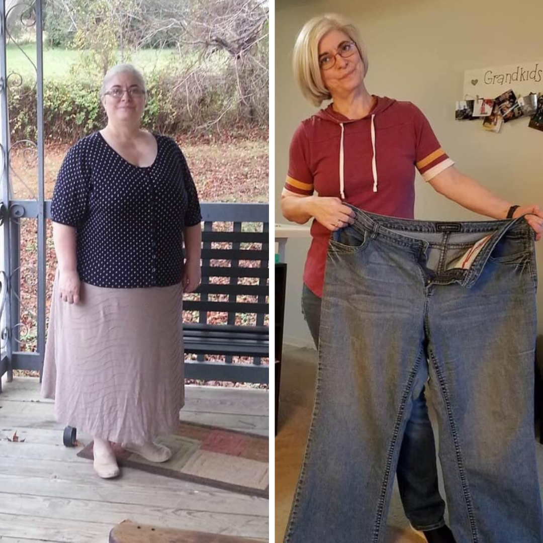 Medical Weight Loss in Tulsa Before & After Photos