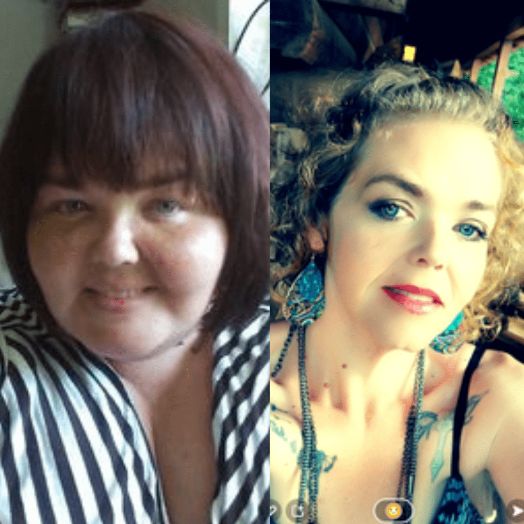 Medical Weight Loss in Tulsa Before & After Photos