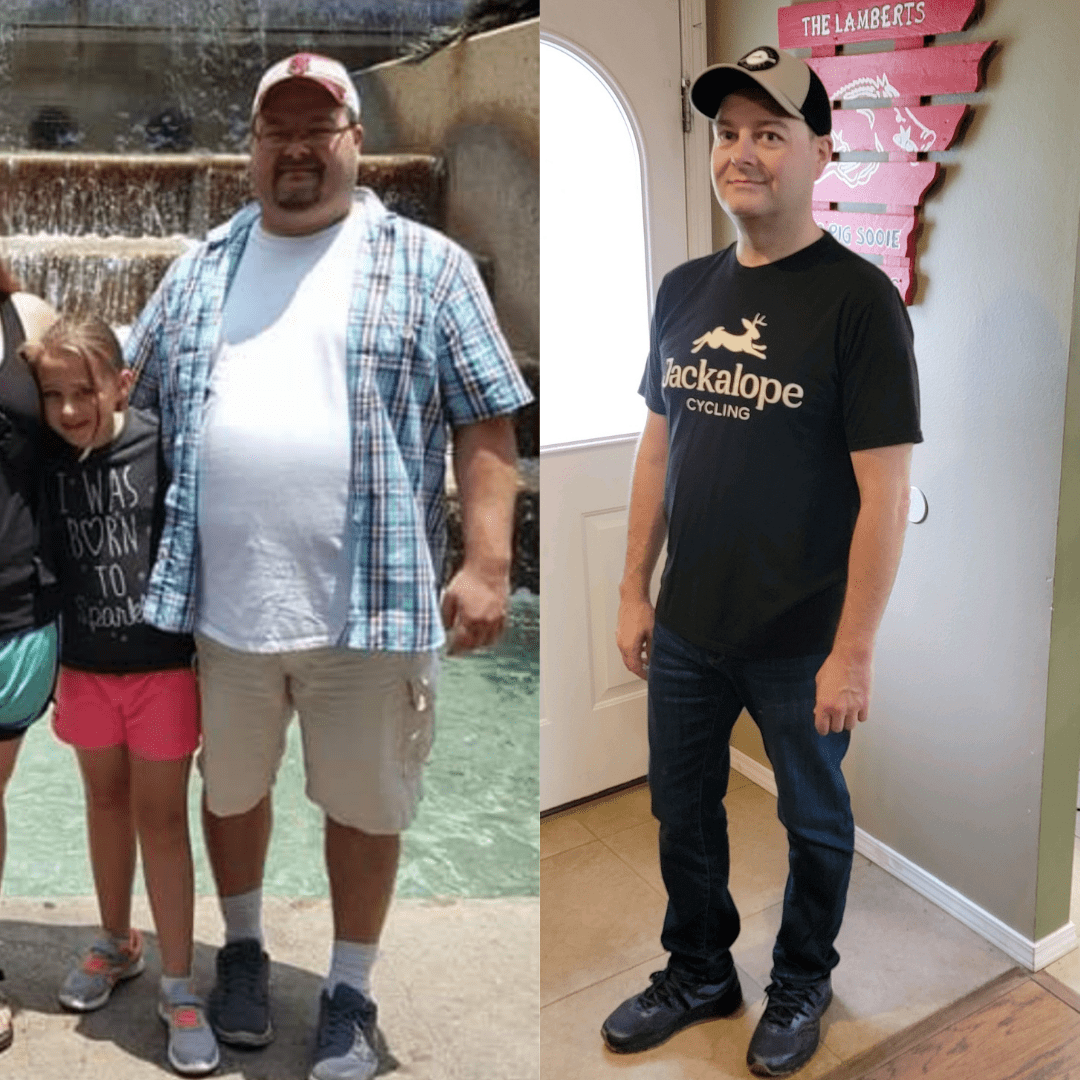 Medical Weight Loss in Tulsa Before & After Photos