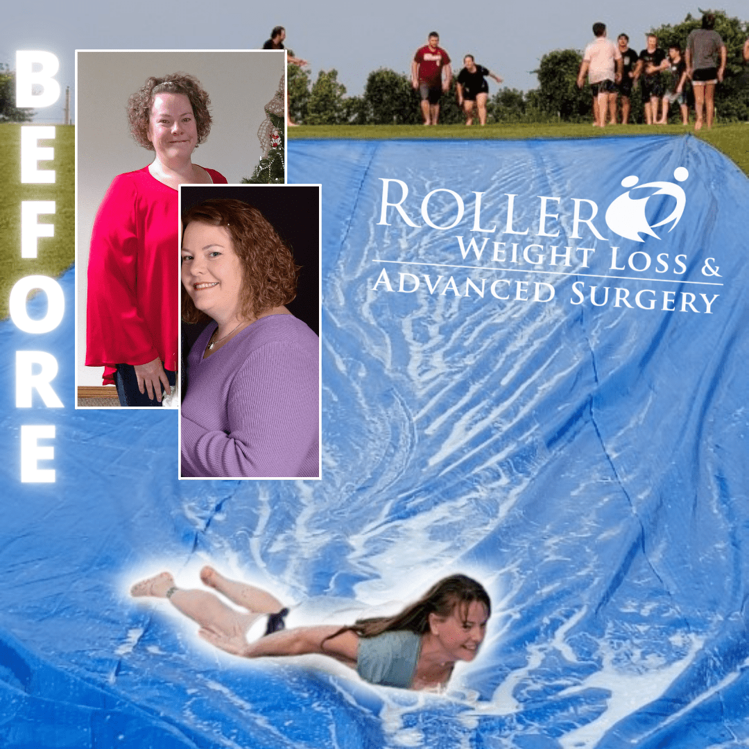 Medical Weight Loss in Tulsa Before & After Photos