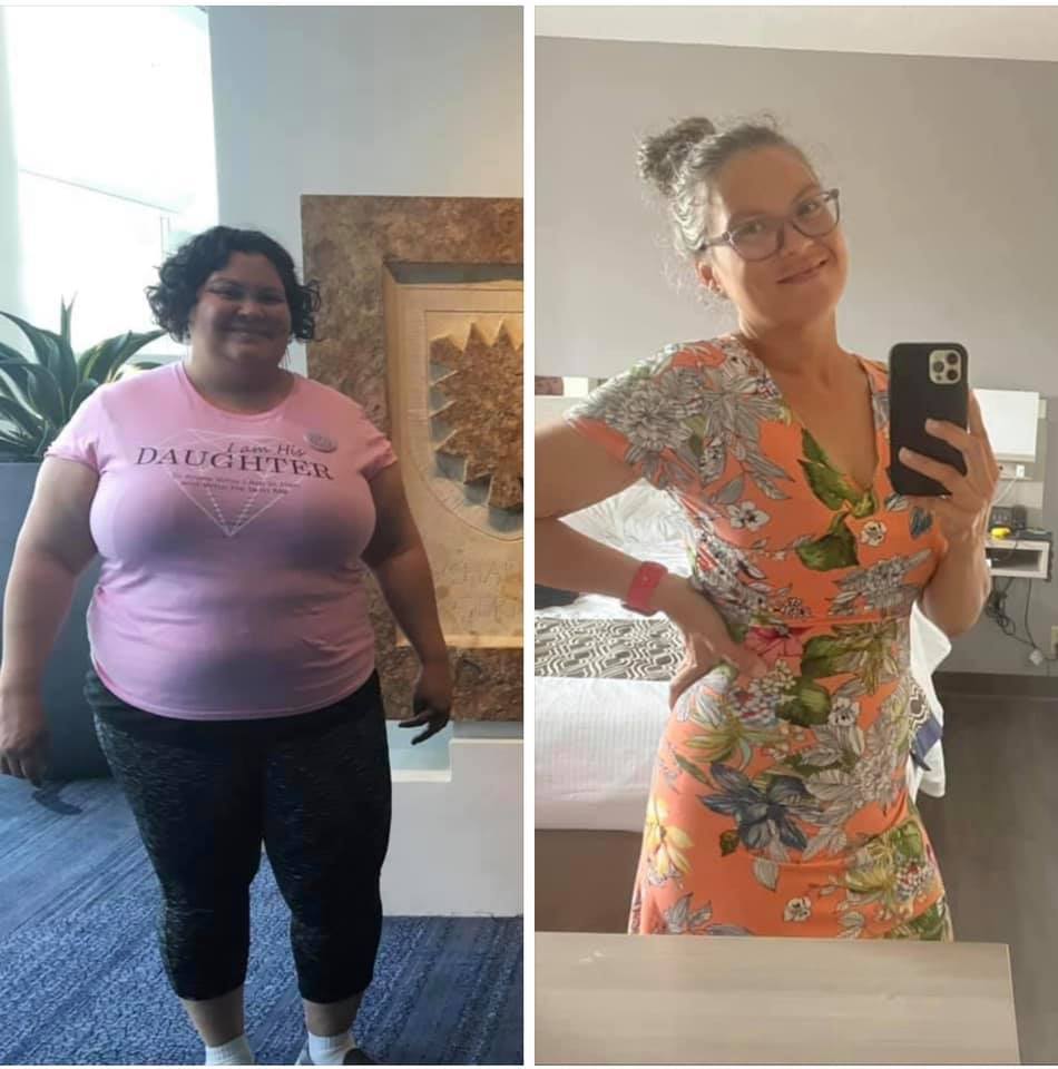 Medical Weight Loss in Tulsa Before & After Photos