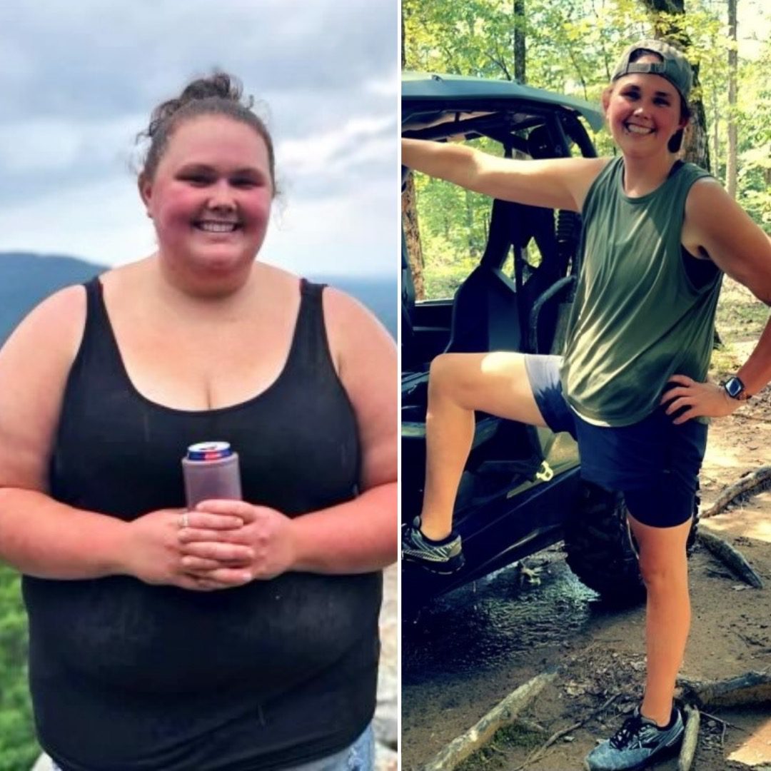 Medical Weight Loss in Tulsa Before & After Photos