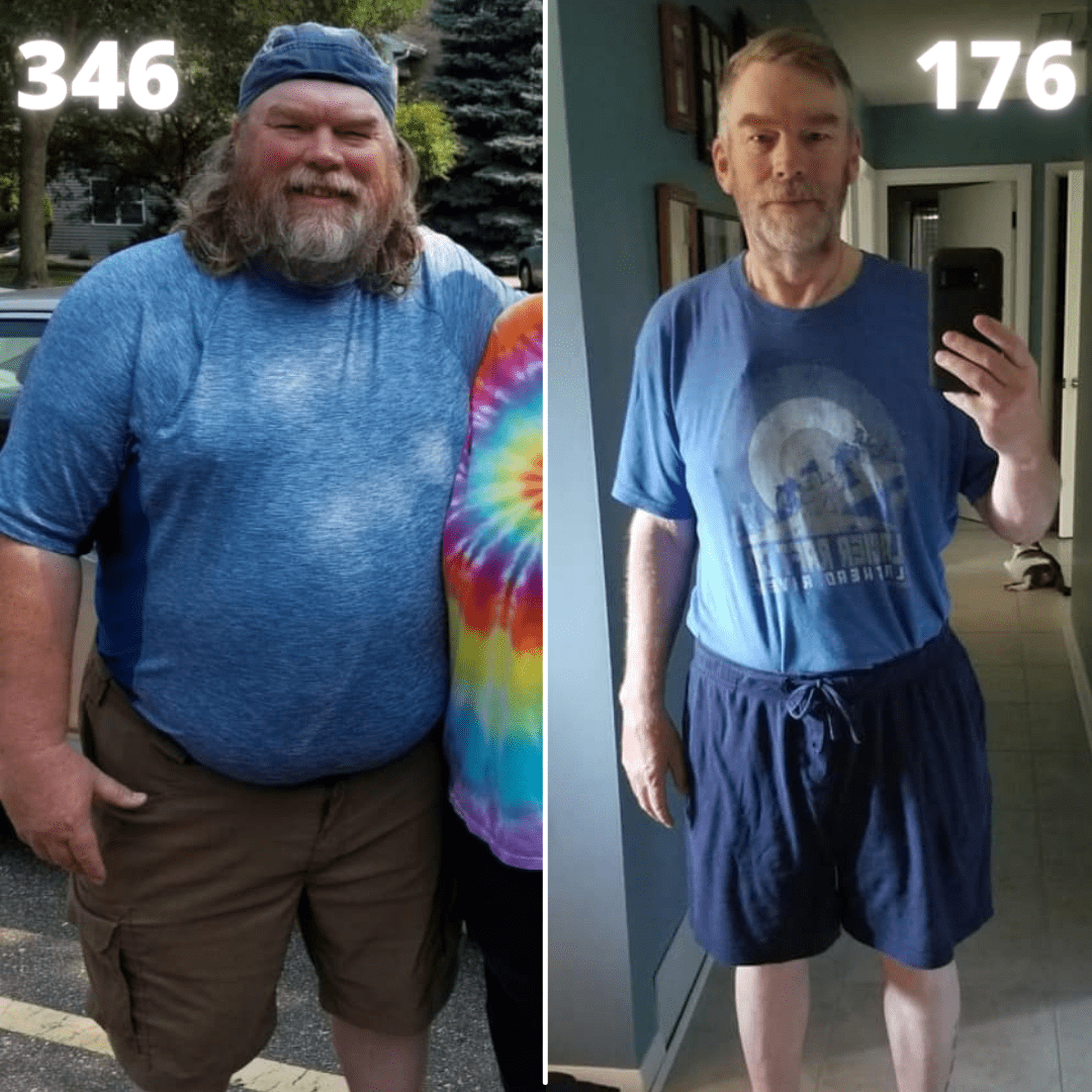 Medical Weight Loss in Tulsa Before & After Photos