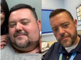 Medical Weight Loss in Tulsa Before & After Photos