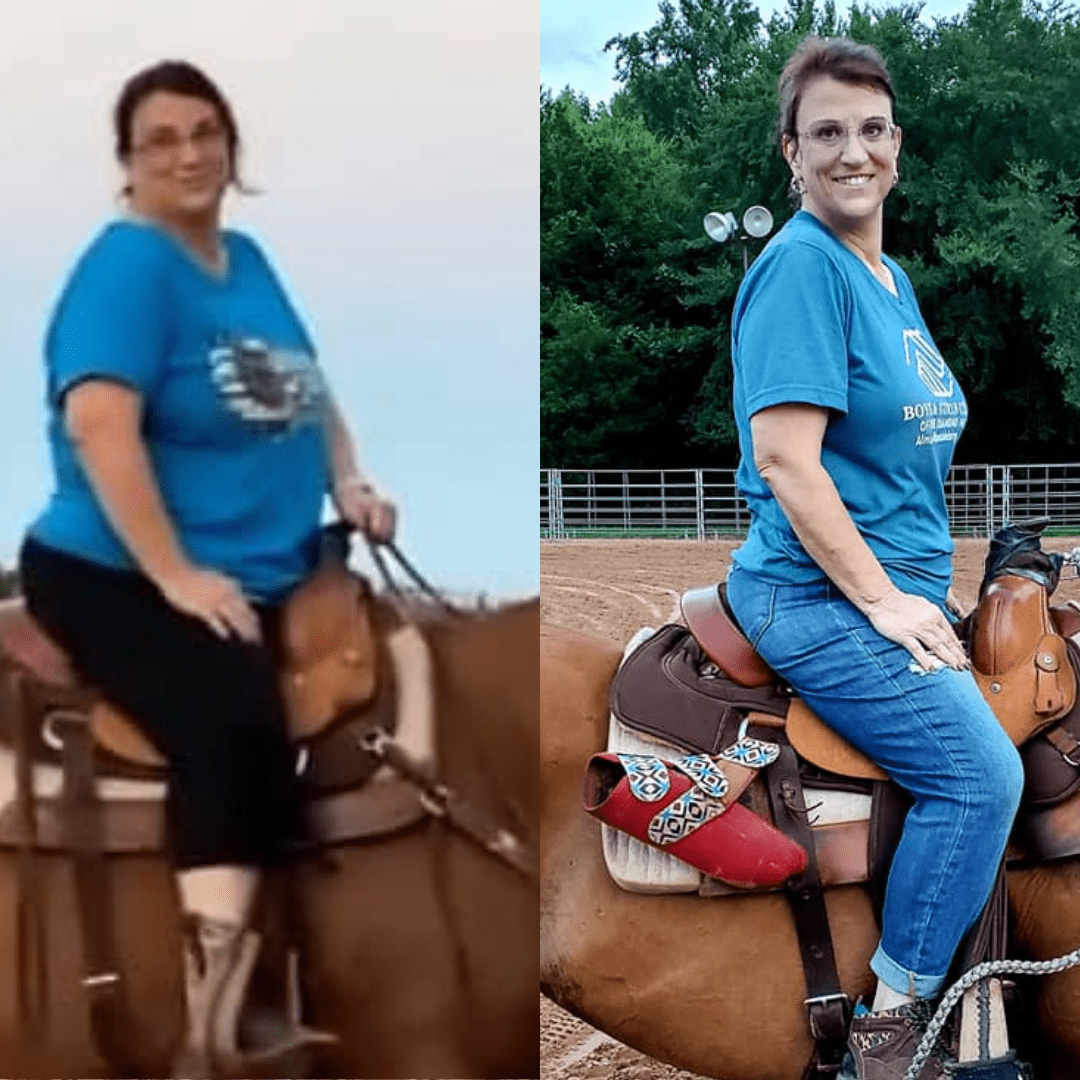 Medical Weight Loss in Tulsa Before & After Photos